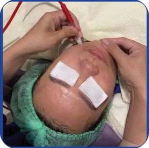 Facial Luxury Anti Aging